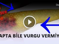 Çok geç olmadan öğrenin! En Sinsir kanser türü..Hızla yayılıyor. Anlamanın en kolay yolu ise..