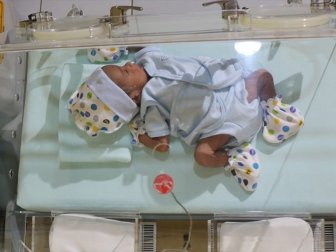 Her Yıl 15 Milyon Bebek Hayata Erken Başlıyor