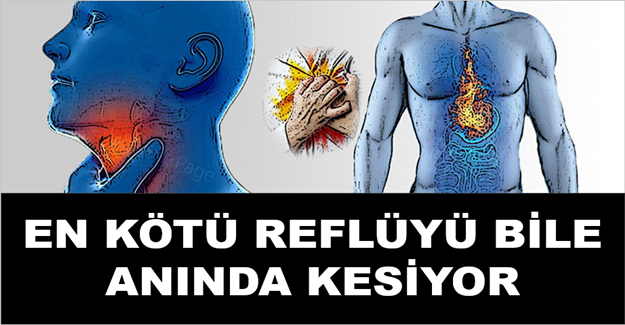 Mide yanmasına en doğal tedavi