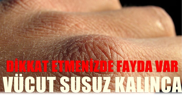 Yeterince Su İçmesiğinizde Vücudunuz Size Bu 8 Sinyali Veriyor