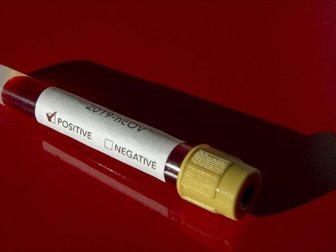 Kovid-19 Testi Yaptıranlar Sonuçlara 'e-Nabız'dan Ulaşabilecek