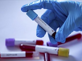Türkiye'de Son 24 Saatte 1615 Kişinin Daha Koronavirüs Tedavisi Tamamlandı