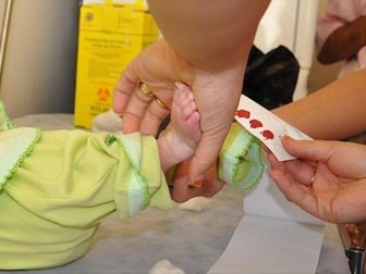 Türkiye'de Her Yıl Yaklaşık 300 Fenilketonüri Bebek Doğuyor