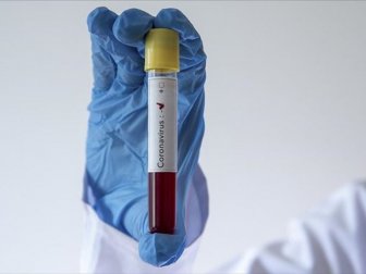 Üst Klasman Hakemlerinin Yeni Tip Koronavirüs Testleri Negatif Çıktı