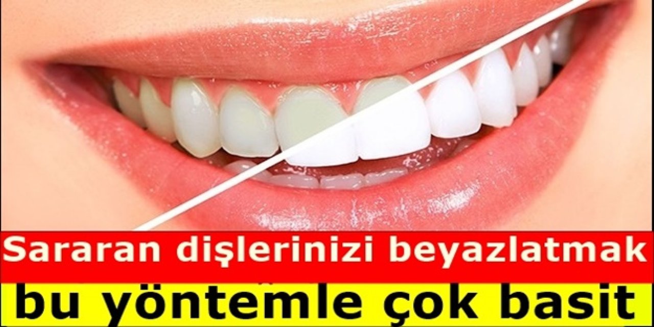Sararmış Dişlerinize Sadece bir miktar sürüp bırakın beyazlatıyor