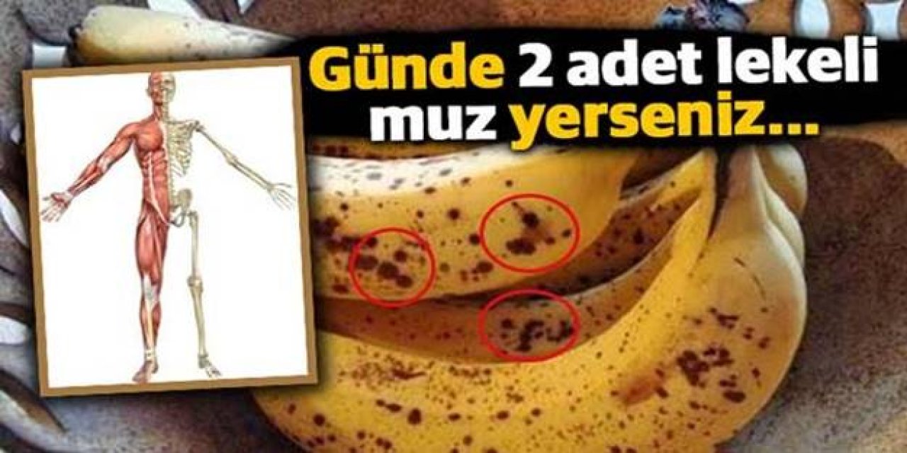 30 Gün boyunca Günlük 2 Adet Lekeli Muz Yerseniz O sorun geçiyor