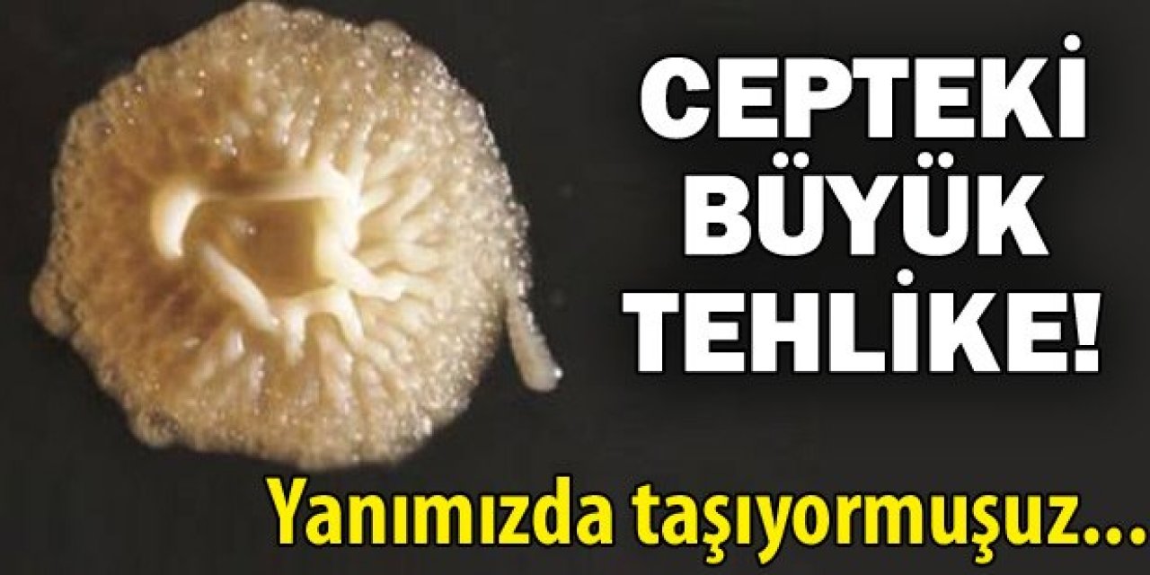 Cep Telefonunuzu Islak Mendille Temizlemeyi Bırakın Çünkü tehlike büyük