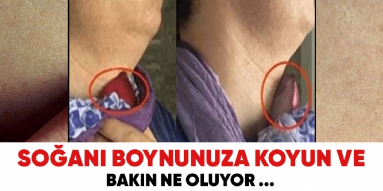 Soğanı Soyup Boynunuza bağlarsanız o sorun geçer