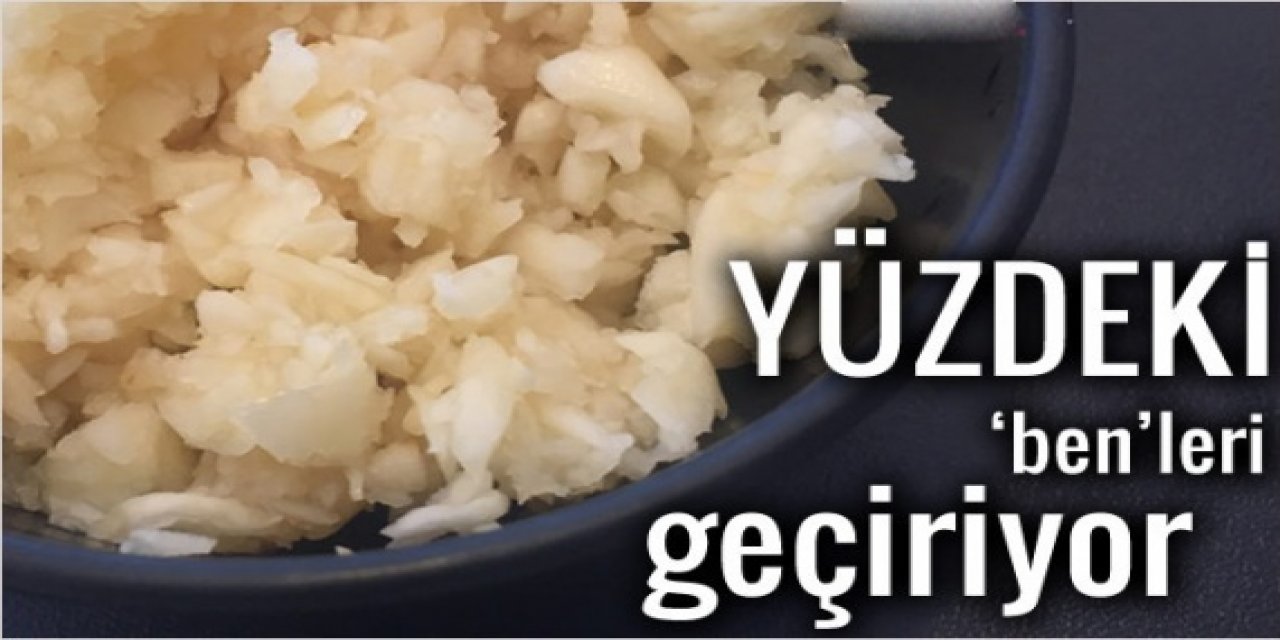 1 Çay Kaşığı bile Sürmek Yüzdeki Ben'leri geçirmeye yetiyor