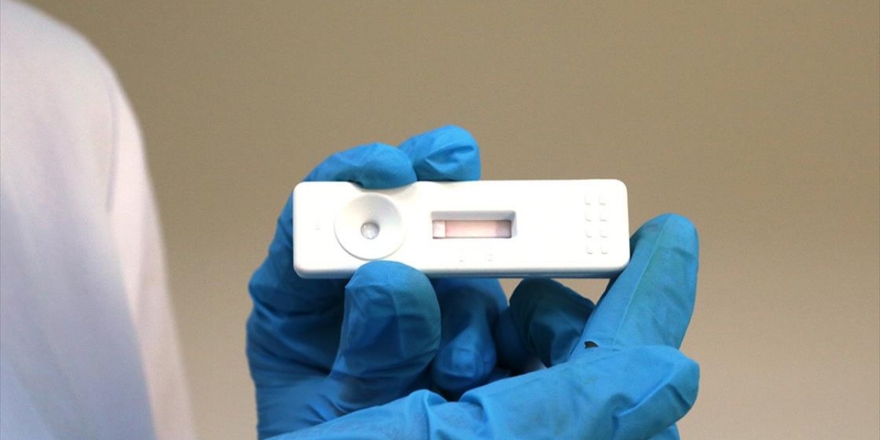 8 Dakikada Koronavirüs Tanısı Koyan Test Kiti Geliştirildi