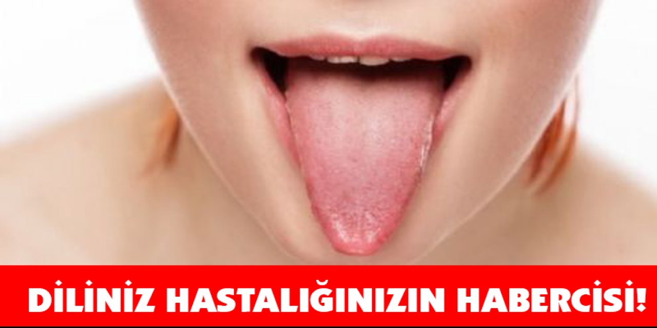 Dilinize Bakın hastalığınızı size söylüyor İşte o belirtiler
