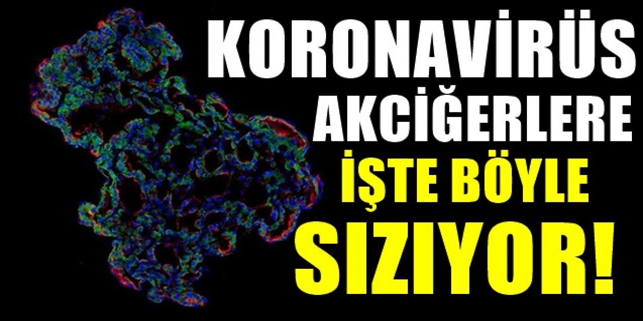 Ciğerleri nasıl ele geçirdiği ve yayıldığı ortaya çıktı!