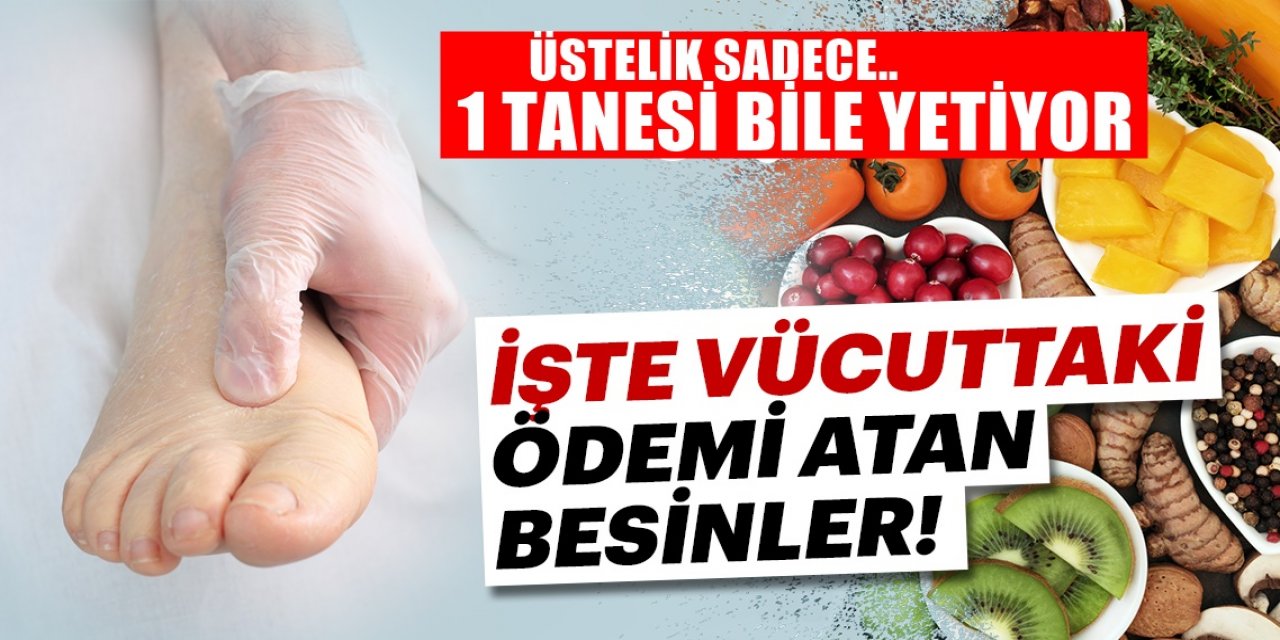 Vücuttaki ödemi yok etmek en etkili 9 yiyecek üstelik 1 gecede ödemi geçirir
