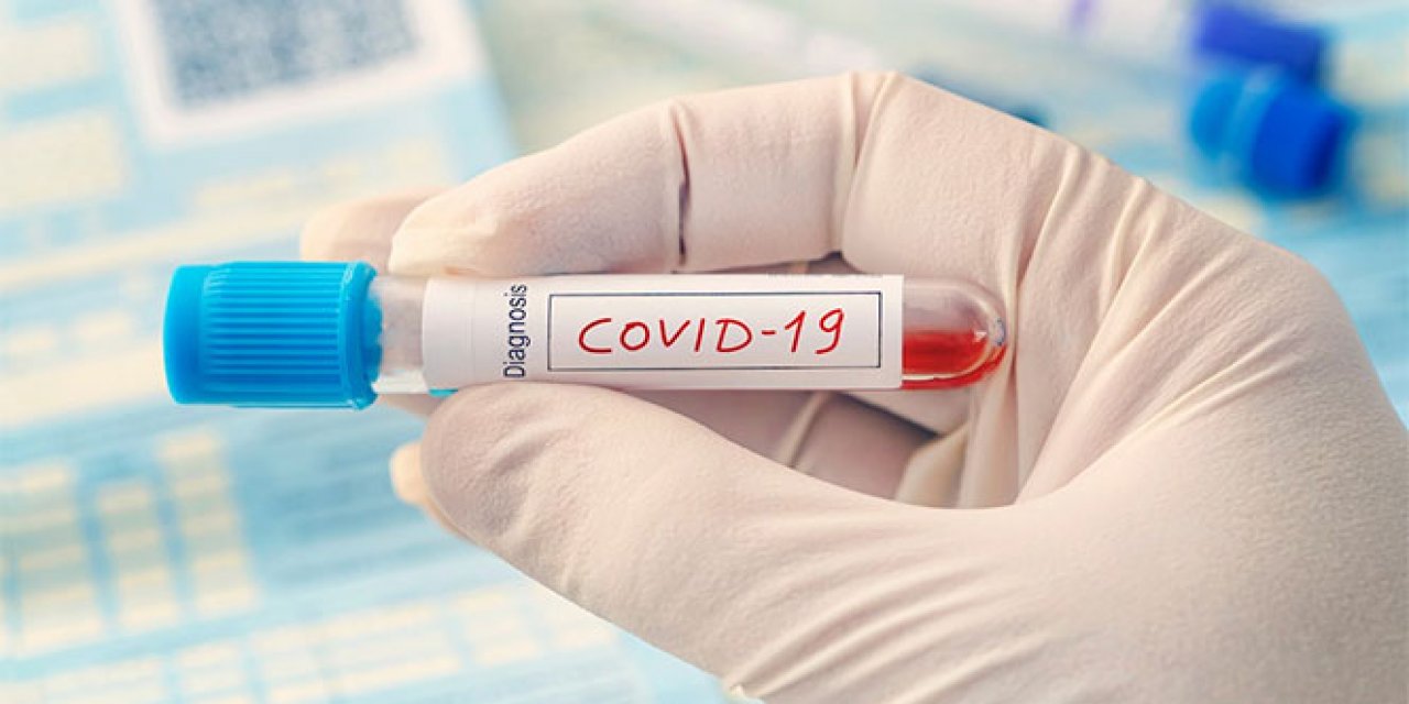 Bu Kadarı Pes Dedirtti! Kovid-19 Test Sonuçlarına Hile Karıştıran Çete Yakayı Ele Verdi