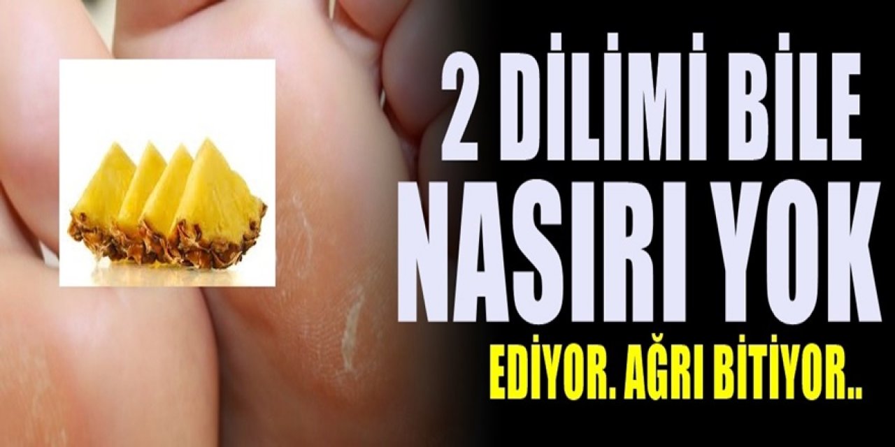 Ne acıdır acısı Nasır bu tarifle kolaylıkla yok edilebilir. Nasır tedavisinde bitkisel yöntem.
