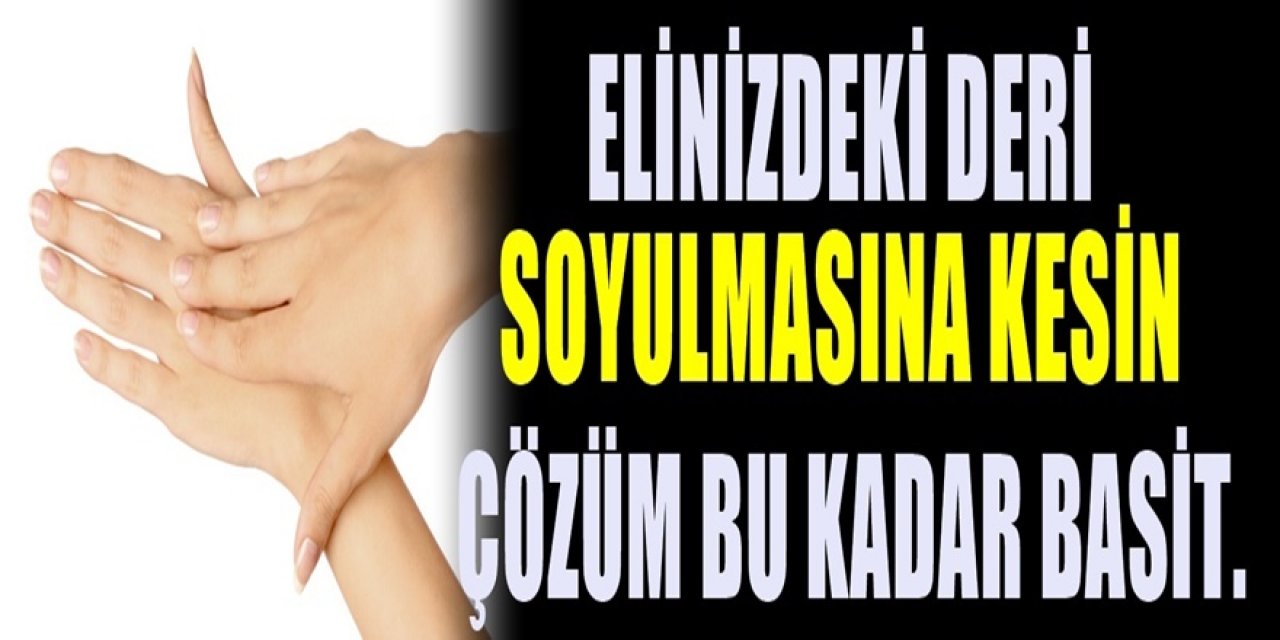 Ellerde Deri Soyulması Nedenleri ve Tedavisi Nelerdir?