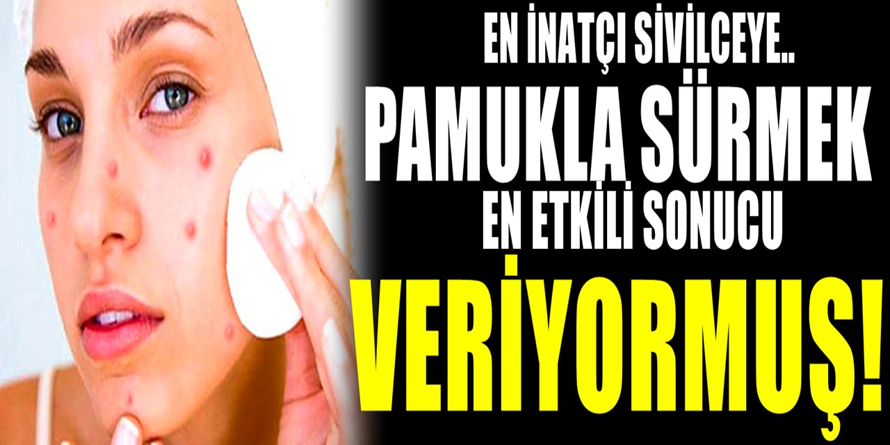 Sivilce Neden Çıkar ve Nasıl Geçer? Bu yöntem gerçekten işe yarıyor..