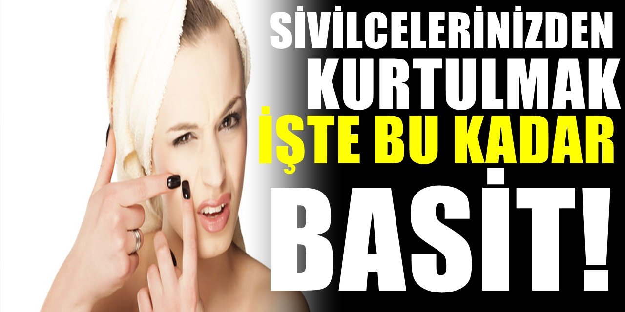 Sivilceye Karşı Dikkat Edilmesi Gerekenler. Sivilceden kurtulmanın yolu bu kadar basitmiş..