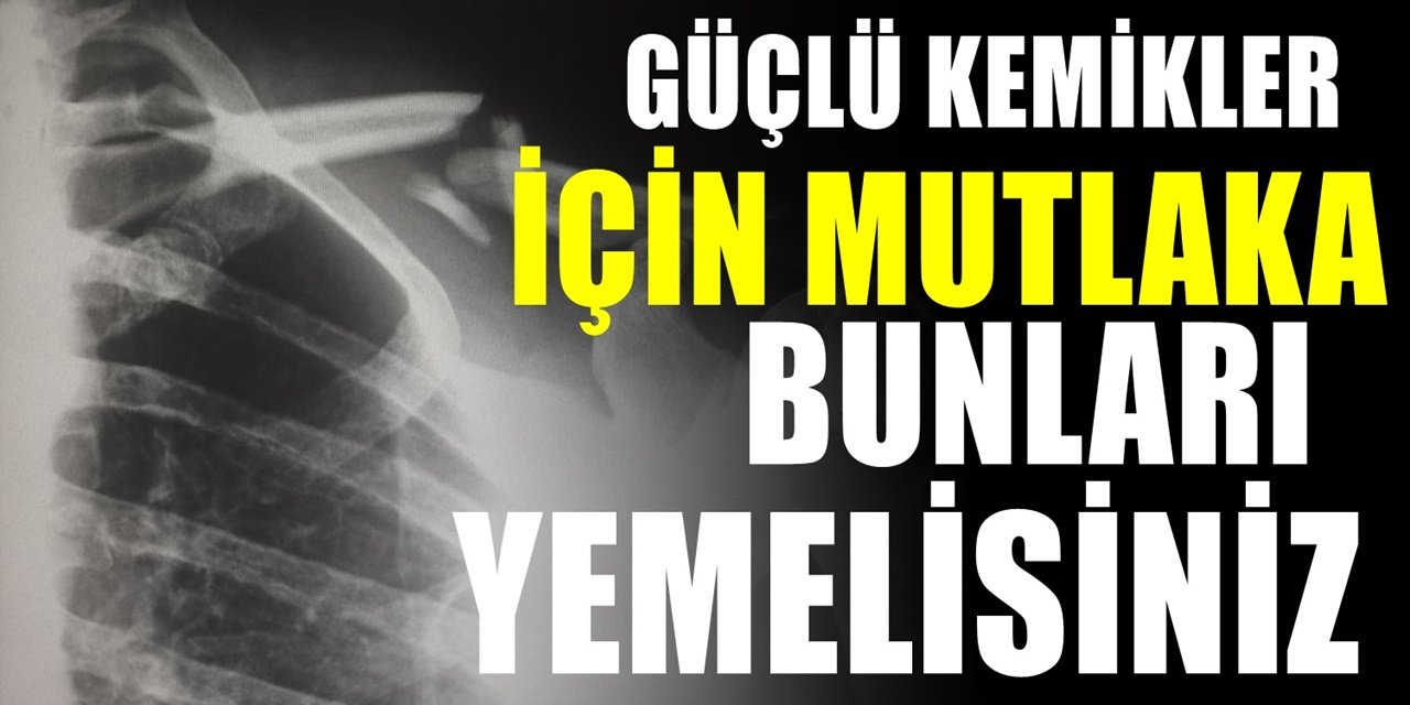 Kemiklerin Direncini Güçlendiren Besinler. Kemik sağlığınız için mutlaka düzenli olarak yemelisiniz