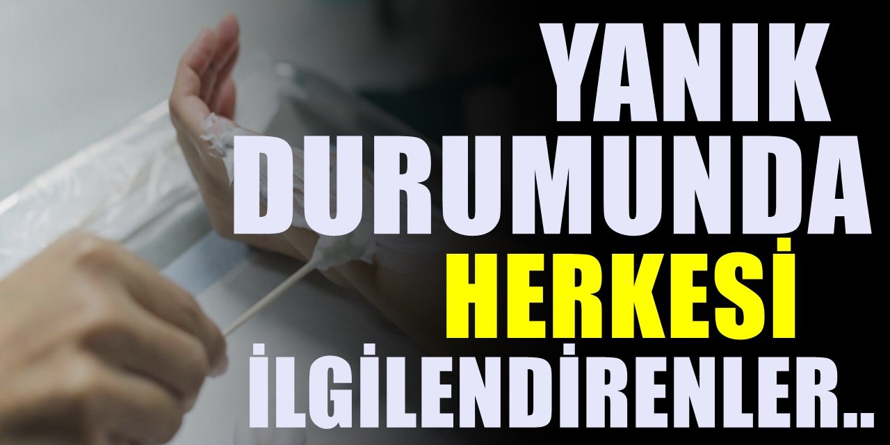 Yanık Nasıl Geçer? İlk Yapılması Gerekenler Nelerdir?