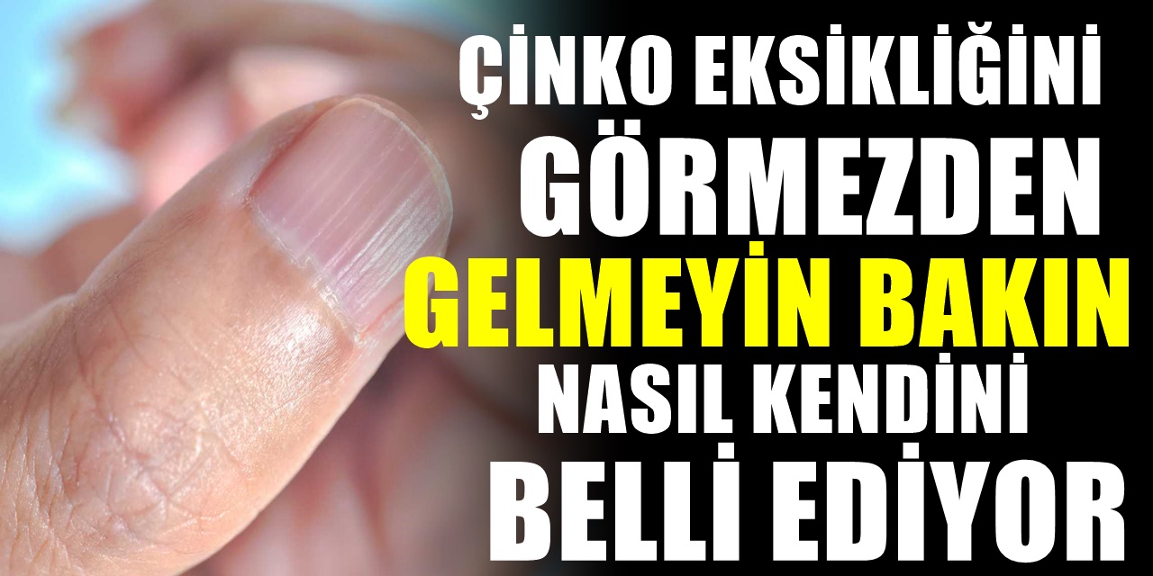 Pandemi Döneminde Çinko Eksikliğine Dikkat Etmelisiniz! Hangi yiyecekler çinko içerir?