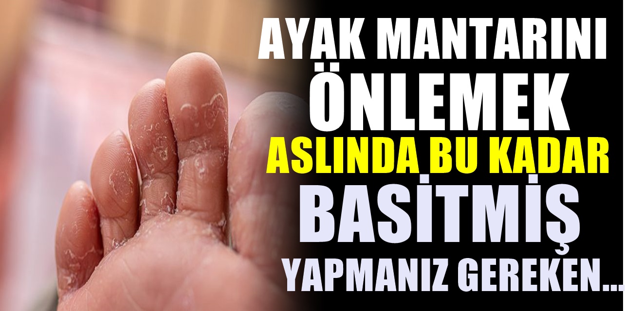Ayak Mantarı Nedir, Tedavisi Nasıldır? Ayaklarda oluşan mantarlardan böyle kurtulun