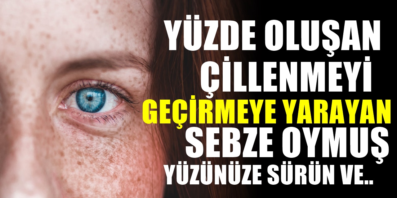 Yüzdeki çiller nasıl geçer? Yüzdeki çilleri geçiren bitkisel çözüm