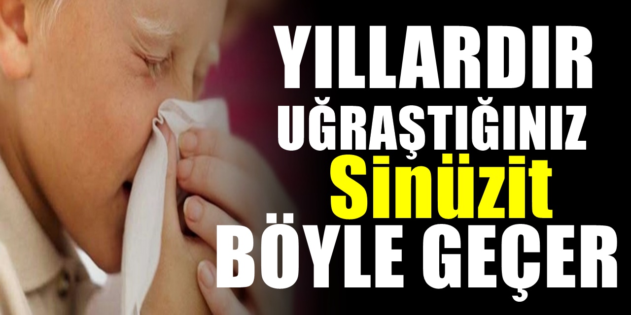 Sinüzitin Belirtileri Nelerdir, Sinüzite Ne İyi Gelir?