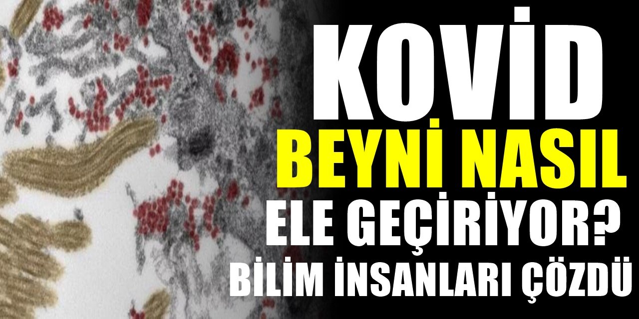 Bilim insanları büyük gizemi çözdüler . Koronavirüsün beyni nasıl ele geçirdiği ortaya çıktı
