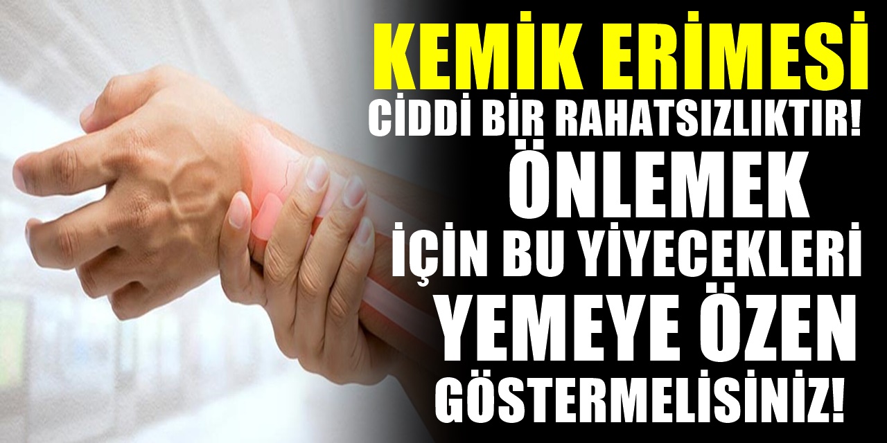 Kemik erimesi ciddi bir rahatsızlıktır. Peki kemik erimesinden kurtaran yiyecekler nelerdir?..