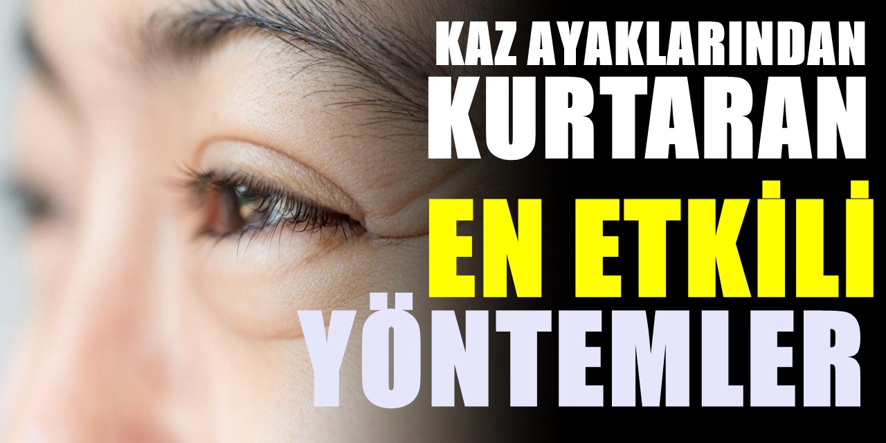 Kaz ayakları nasıl yok edilir? Cildinizi güzelleştirmede makyaja gerek kalmadan etkili olan yöntemler