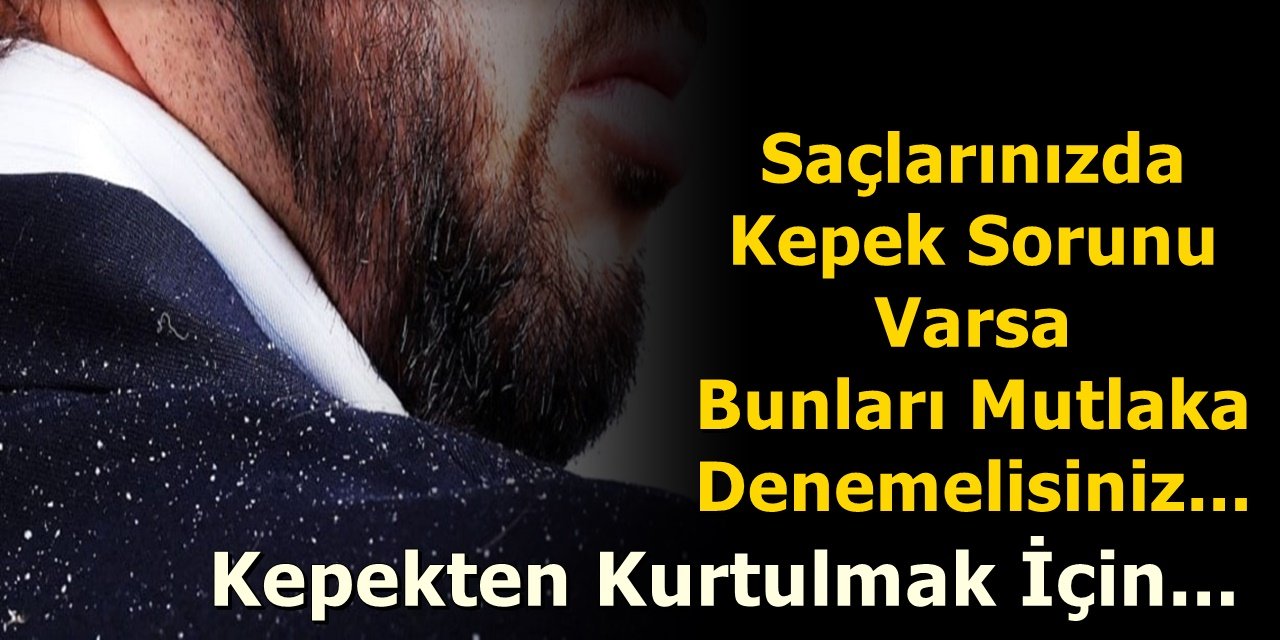 Saçlarınızda Kepek Sorunu Varsa Bunları Mutlaka Denemelisiniz.. Kepekten Kurtulmak İçin...