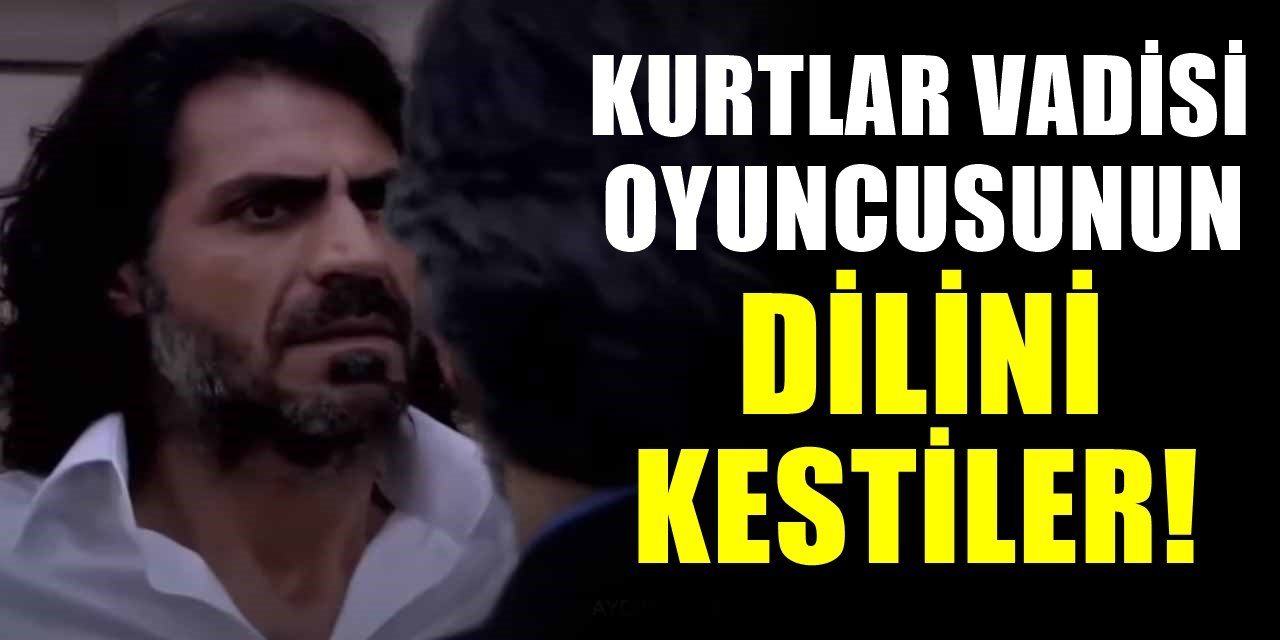 Şaka değil gerçek Kurtlar vadisi Dizisinin oyuncusunun dili kesildi! Hastaneye dava şoku