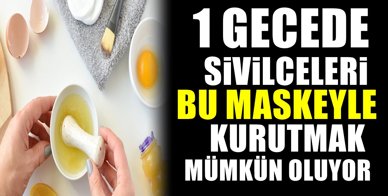 1 Gecede Sivilceleri Yok Edip Kurutmak Mümkün Bu Tarifi Hemen Deneyin