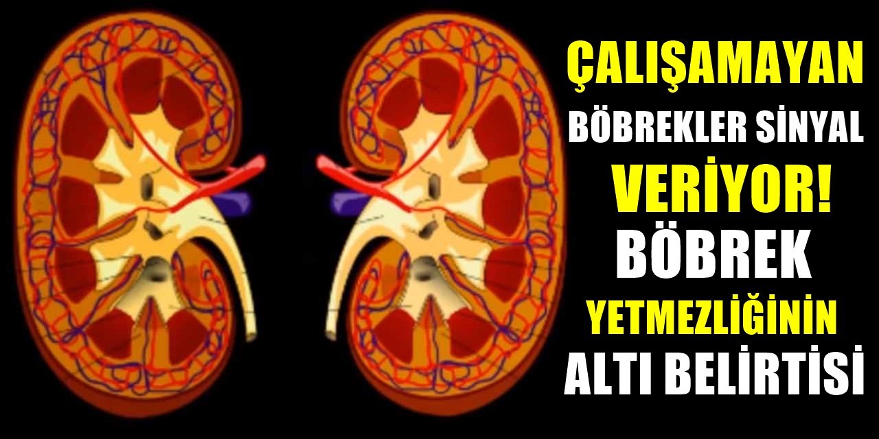 Diyalize mahkum olmamak için vücudunuzun bu uyarısına kulak verin böbrekleriniz iflas etmiş olabilir