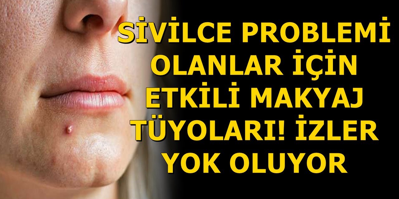 Sivilce Problemi olanlar için etkili makyaj tüyoları! İzler yok oluyor
