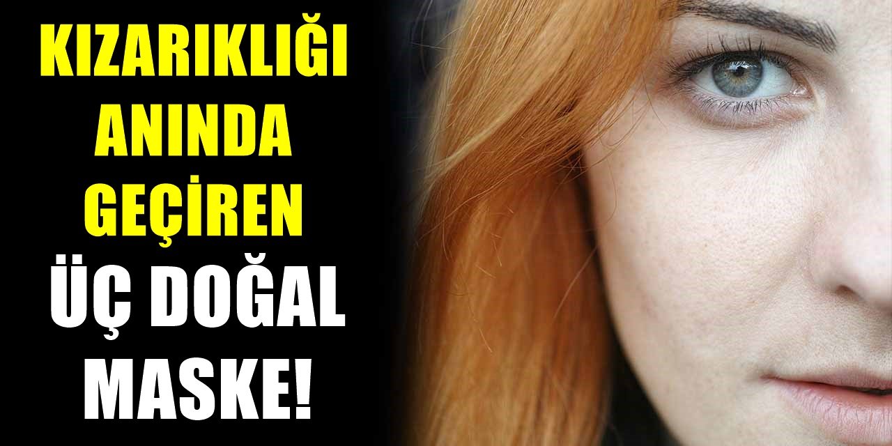 Kırmızı Cilde Son! Yüzdeki Kızarıklığı Geçirmek İçin Tamamen Doğal Yöntem!