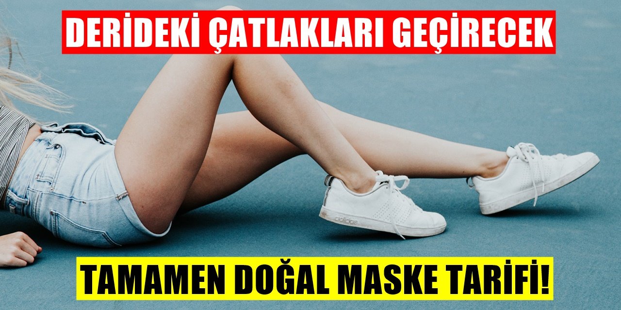 Bacak Çatlaklarına İyi Gelecek Maske Tarifi! Tamamen Doğal Ürünlerle Çatlaklara Son!