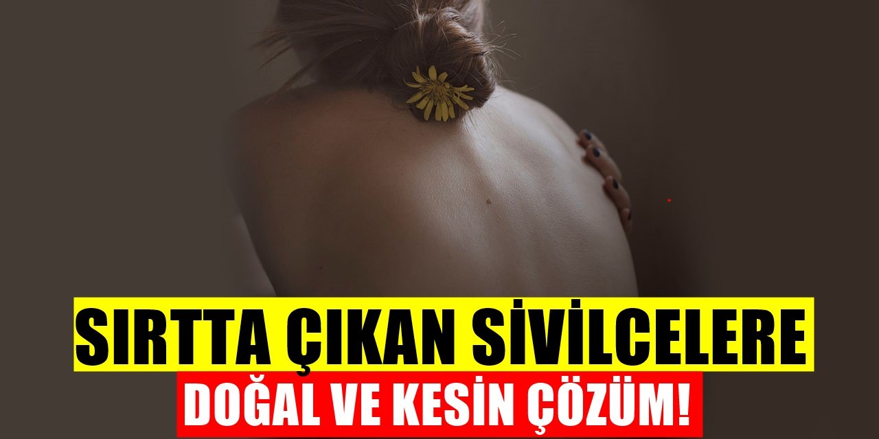 Sırtta Çıkan Sivilce Nasıl Geçer? Sırttaki Sivilceleri Geçiren Yöntem
