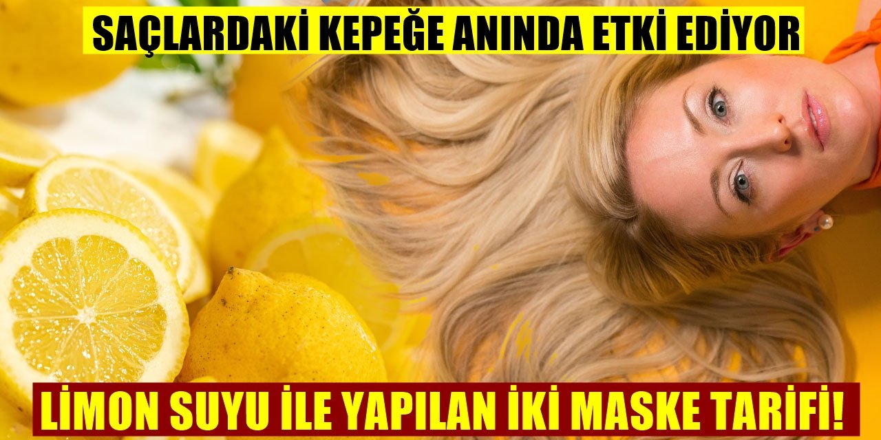 Kepekli Saçlardan Kurtaran Formül! Limon Suyu ve...