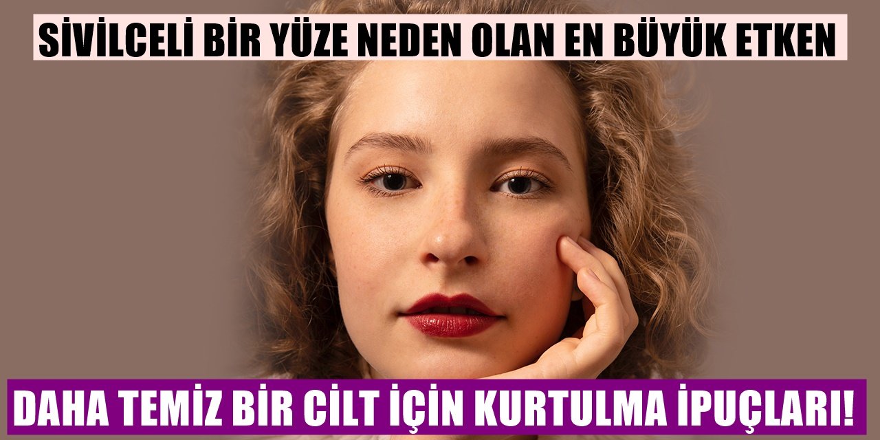 Yüzde Oluşan Sivilcenin En Büyük Sebebi! O Alışkanlıktan Kurtulmanın Yolları....