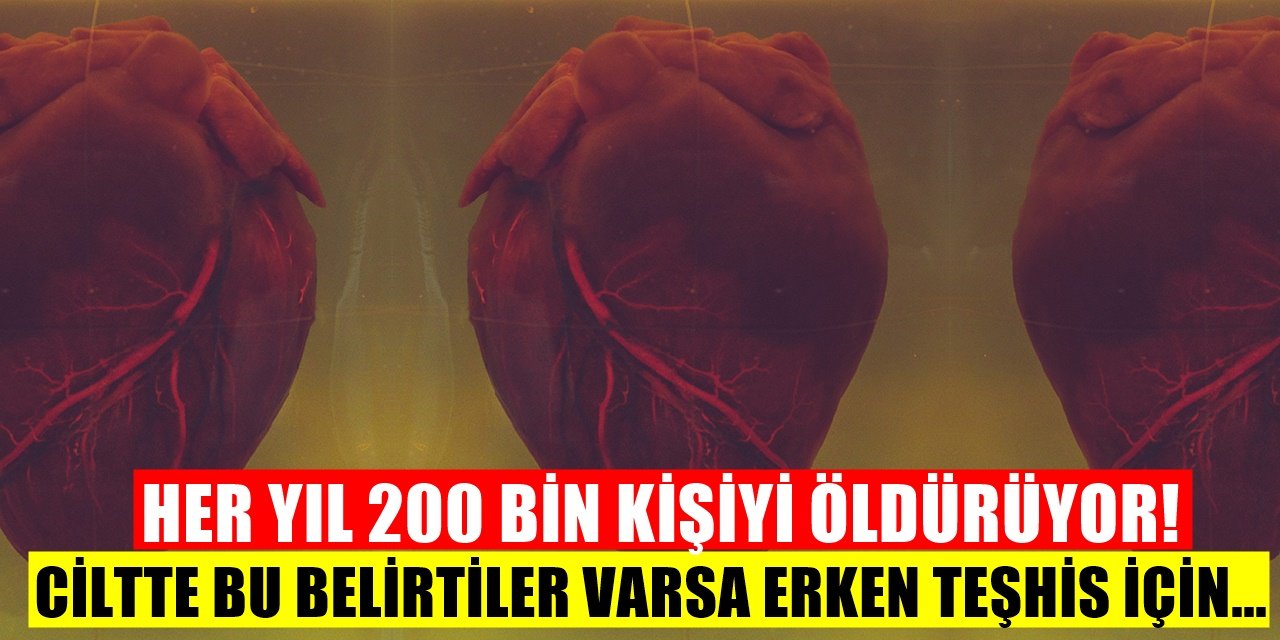Ciltteki Bu Belirtiler O Hastalığın Habercisi Olabilir... Türkiye'de Her Yıl İki Yüz Bin Kişinin Ölüm Nedeni...