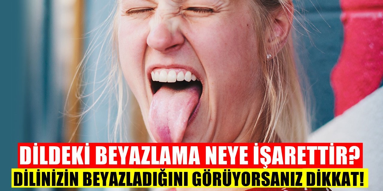 Dilde Meydana Gelen Beyazlık Neye İşarettir? Dil Neden Beyazlaşır?