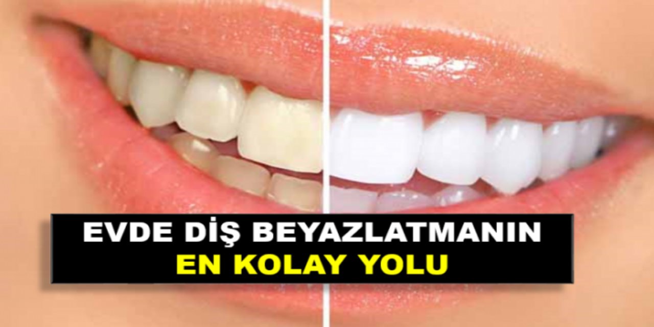 Sararmış Dişlerinizi bu tarifle 10 dakika içerinde bembeyaz yapabilirsiniz