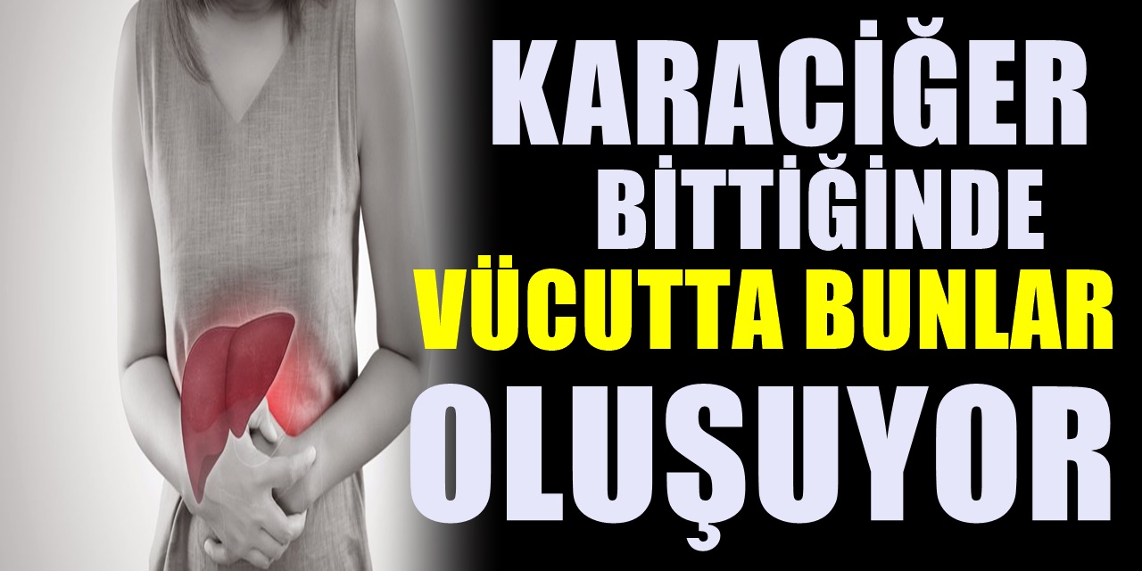 Karaciğerin bittiğini gösteriyormuş. Vücudunuzdaki bu belirtilere dikkat ediniz