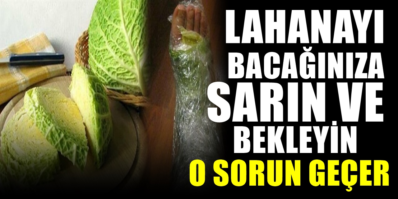 Bacaklarınıza Lahana Sarıp bir süre bekleyin bakınız ne işe yarıyormuş..