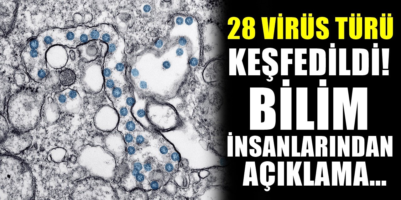 Bilim İnsanlarından Korkutan açıklama! 28 farklı virüs daha tespit edildi