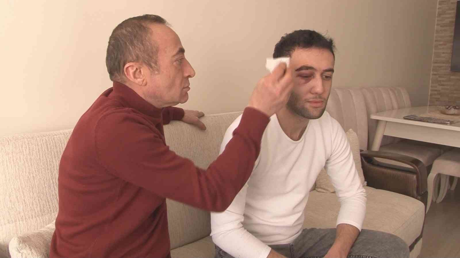 Darp Edilen A101 Çalışanı Yaşadığı Korkunç Anları Anlattı! Bir Şeker Uğruna Olay başlamış