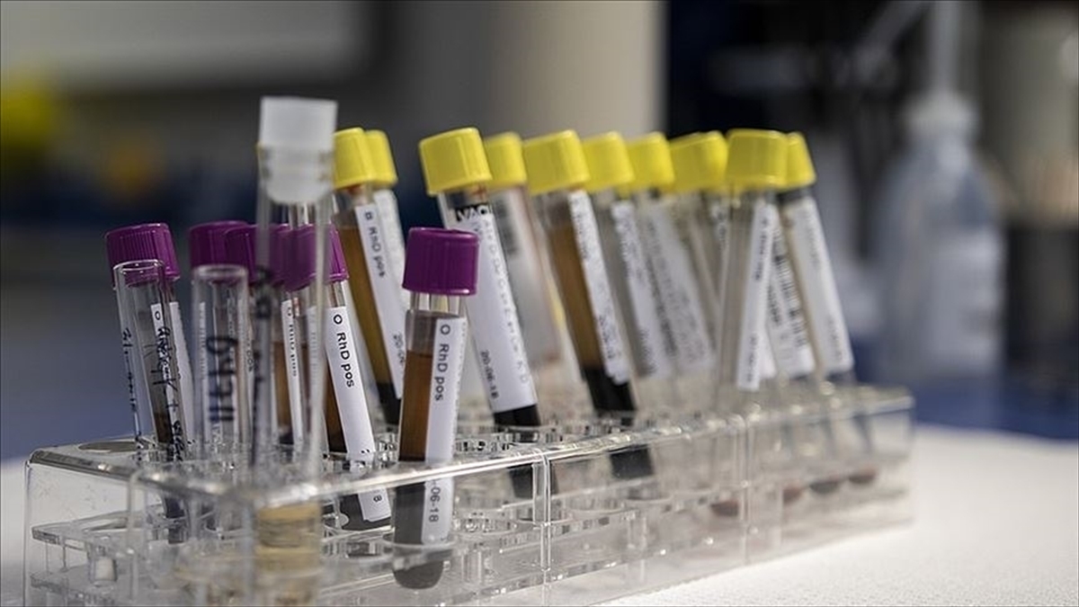 Dsö: Gizemli Hepatit Vakalarının Kovid-19 Aşılamasıyla Bağlantısının Olmadığını Bildirdi
