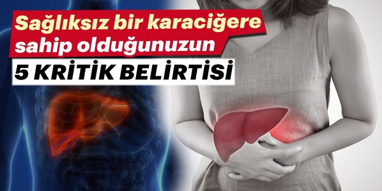 Vücudunuz Sizi Çok Önceden Uyarıyor – Sağlıksız Bir Karaciğere Sahip Olduğunuzun 5 Önemli Belirtisi